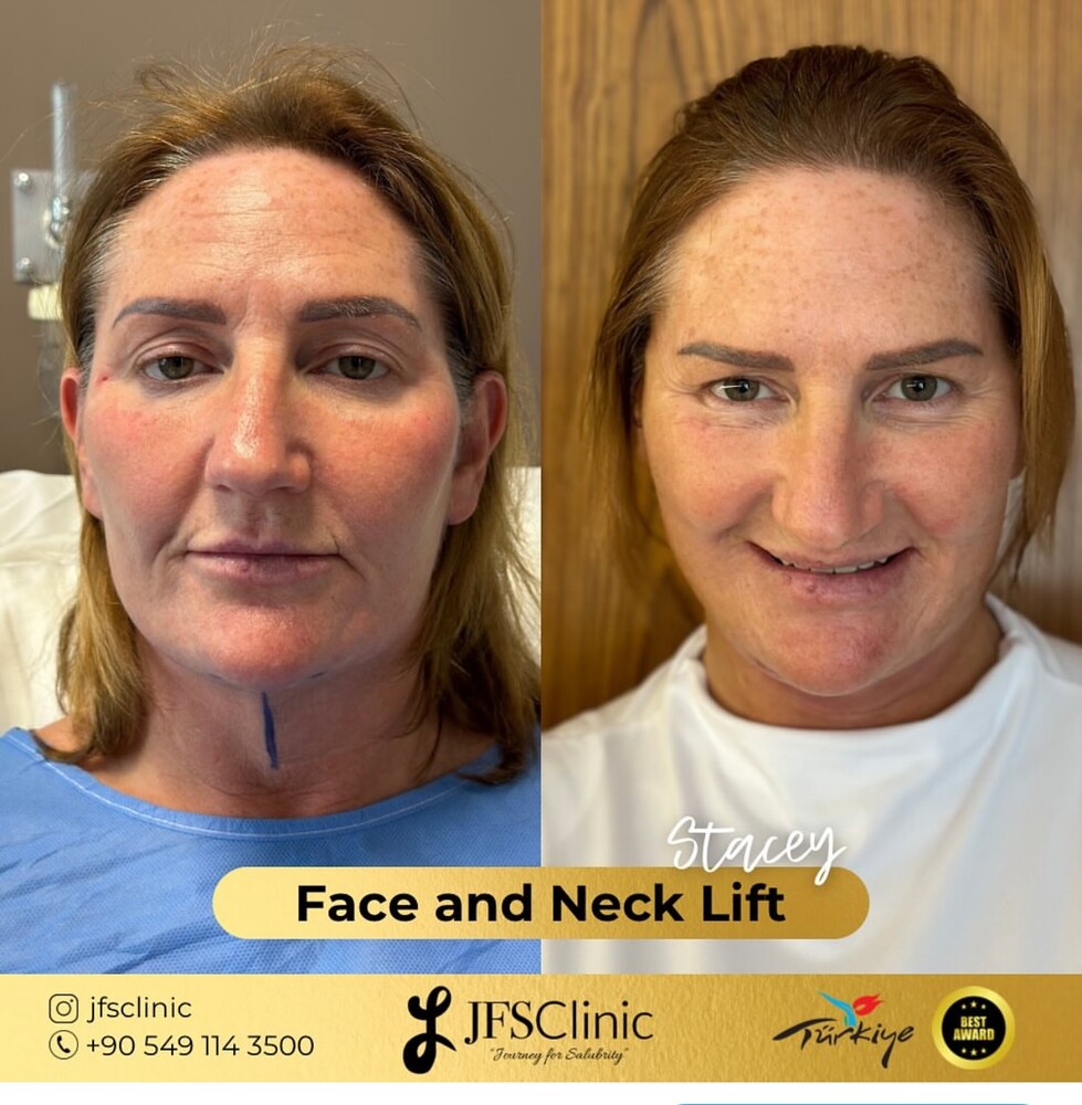 Clinic Results Gallery